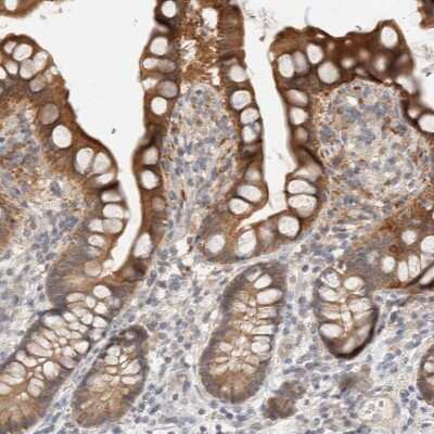 Immunohistochemistry-Paraffin: Carbonic Anhydrase XIII/CA13 Antibody [NBP1-86606]