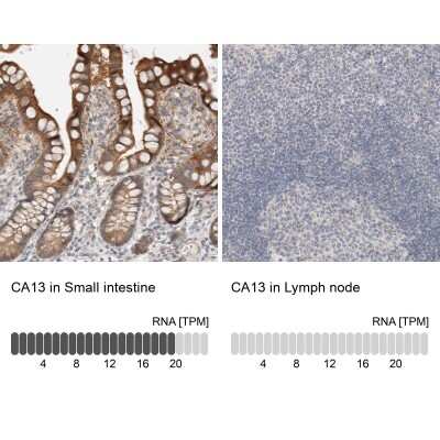 Immunohistochemistry-Paraffin: Carbonic Anhydrase XIII/CA13 Antibody [NBP1-86606]