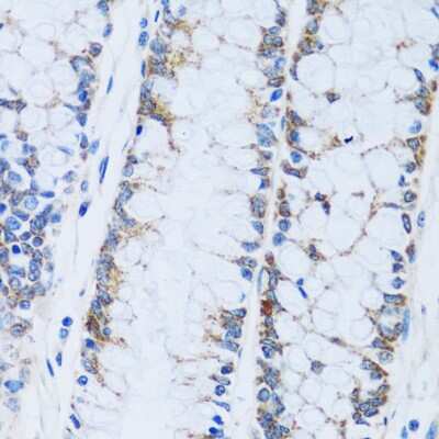 Immunohistochemistry-Paraffin: Carbonic Anhydrase XIII/CA13 Antibody - Azide and BSA Free [NBP2-92743]