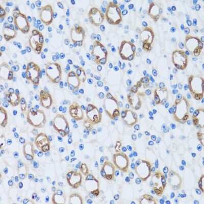 Immunohistochemistry-Paraffin: Carbonic Anhydrase XIII/CA13 Antibody - Azide and BSA Free [NBP2-92743]