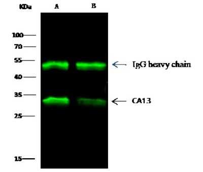 Immunoprecipitation: Carbonic Anhydrase XIII/CA13 Antibody [NBP2-99317]