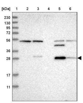 Western Blot: Carbonic Anhydrase XIII/CA13 Antibody [NBP1-86606]