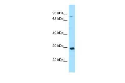 Western Blot: Carbonic Anhydrase XIII/CA13 Antibody [NBP2-87124]