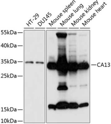 Western Blot: Carbonic Anhydrase XIII/CA13 AntibodyAzide and BSA Free [NBP2-92743]