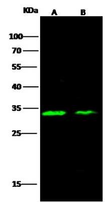 Western Blot: Carbonic Anhydrase XIII/CA13 Antibody [NBP2-99317]