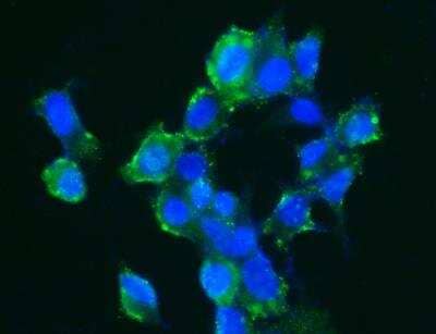 Immunocytochemistry/ Immunofluorescence: Carbonic Anhydrase XIV/CA14 Antibody (515) [NBP2-89510]