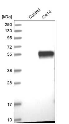 Western Blot: Carbonic Anhydrase XIV/CA14 Antibody [NBP1-87477]