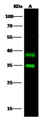 Western Blot: Carbonic Anhydrase XIV/CA14 Antibody [NBP2-98206]