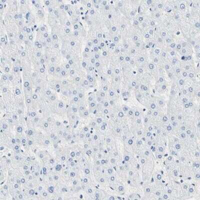 Immunohistochemistry-Paraffin: Carboxyl Ester Lipase/CEL Antibody [NBP1-88502]