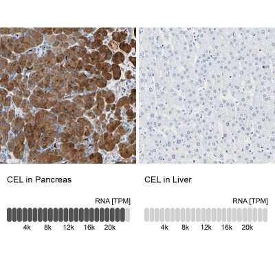 Immunohistochemistry-Paraffin: Carboxyl Ester Lipase/CEL Antibody [NBP1-88502]