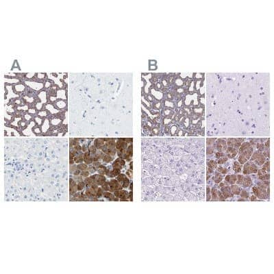 Immunohistochemistry-Paraffin: Carboxyl Ester Lipase/CEL Antibody [NBP1-88502]