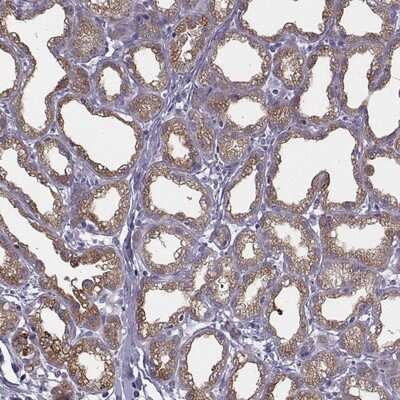 Immunohistochemistry-Paraffin: Carboxyl Ester Lipase/CEL Antibody [NBP2-33663]