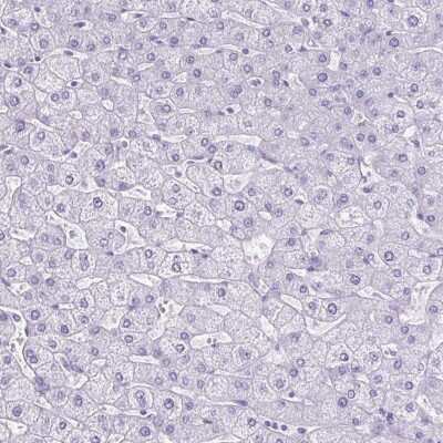 Immunohistochemistry-Paraffin: Carboxyl Ester Lipase/CEL Antibody [NBP2-33663]