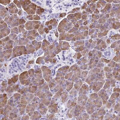 Immunohistochemistry-Paraffin: Carboxyl Ester Lipase/CEL Antibody [NBP2-33663]
