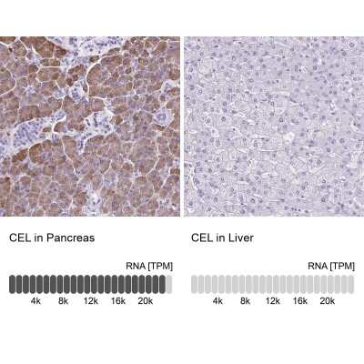 Immunohistochemistry-Paraffin: Carboxyl Ester Lipase/CEL Antibody [NBP2-33663]