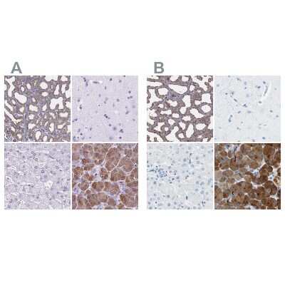 Immunohistochemistry-Paraffin: Carboxyl Ester Lipase/CEL Antibody [NBP2-33663]