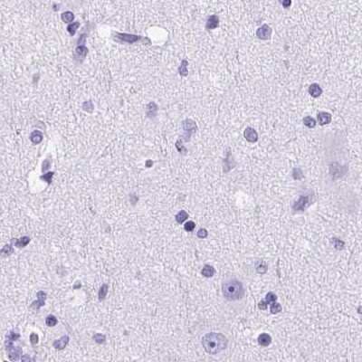 Immunohistochemistry-Paraffin: Carboxyl Ester Lipase/CEL Antibody [NBP2-33663]