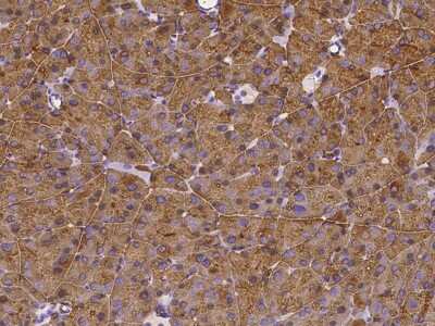 Immunohistochemistry-Paraffin: Carboxyl Ester Lipase/CEL Antibody [NBP2-98314]