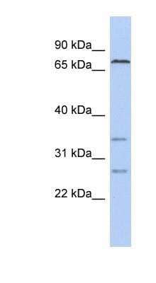 Western Blot: Carboxyl Ester Lipase/CEL Antibody [NBP1-57922]