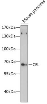 Western Blot: Carboxyl Ester Lipase/CEL AntibodyAzide and BSA Free [NBP2-92101]