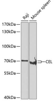 Western Blot: Carboxyl Ester Lipase/CEL AntibodyBSA Free [NBP2-92504]