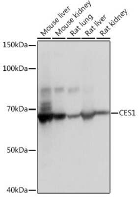 Western Blot: Carboxylesterase 1/CES1 Antibody (7C9R6) [NBP3-15388]