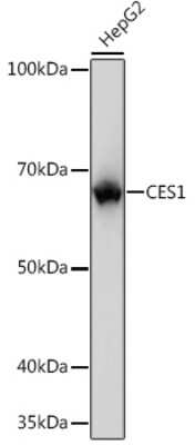 Western Blot: Carboxylesterase 1/CES1 Antibody (7C9R6) [NBP3-15388]