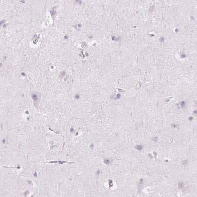 Immunohistochemistry-Paraffin: Carboxylesterase 1/CES1 Antibody [NBP1-85691]