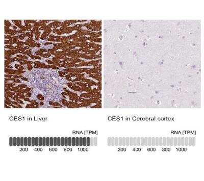 Immunohistochemistry-Paraffin: Carboxylesterase 1/CES1 Antibody [NBP1-85691]