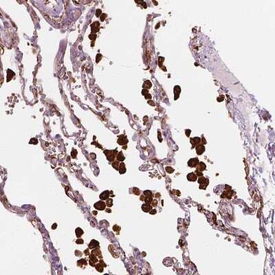 Immunohistochemistry-Paraffin: Carboxylesterase 1/CES1 Antibody [NBP1-85691]
