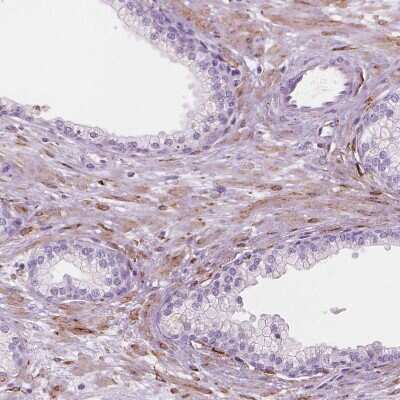 Immunohistochemistry-Paraffin: Carboxylesterase 1/CES1 Antibody [NBP1-85691]