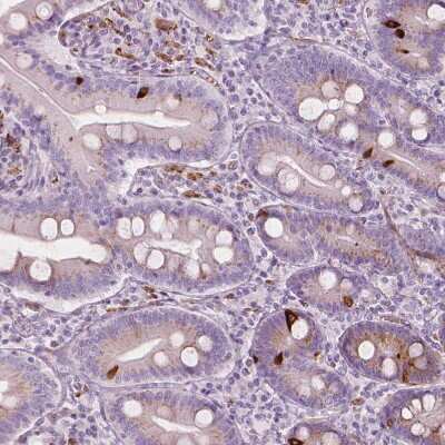 Immunohistochemistry-Paraffin: Carboxylesterase 1/CES1 Antibody [NBP1-85691]