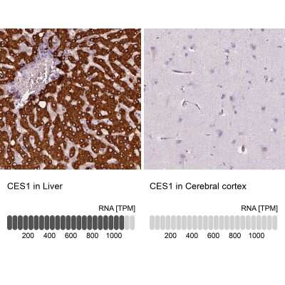 Immunohistochemistry-Paraffin: Carboxylesterase 1/CES1 Antibody [NBP2-48854]