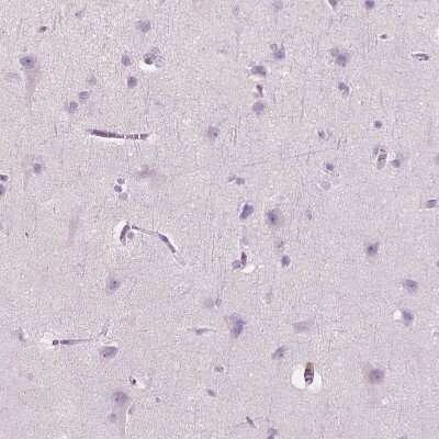 Immunohistochemistry-Paraffin: Carboxylesterase 1/CES1 Antibody [NBP2-48854]