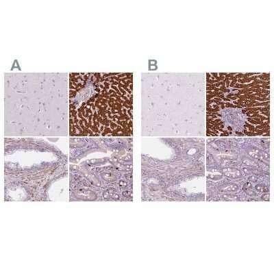 Immunohistochemistry-Paraffin: Carboxylesterase 1/CES1 Antibody [NBP2-48854]