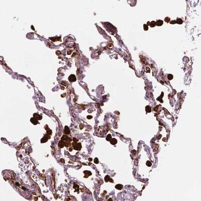 Immunohistochemistry-Paraffin: Carboxylesterase 1/CES1 Antibody [NBP2-48854]