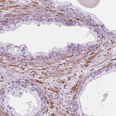 Immunohistochemistry-Paraffin: Carboxylesterase 1/CES1 Antibody [NBP2-48854]