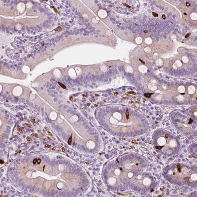 Immunohistochemistry-Paraffin: Carboxylesterase 1/CES1 Antibody [NBP2-48854]