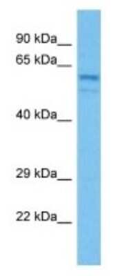 Western Blot: Carboxylesterase 1C/CES1C Antibody [NBP3-10111]