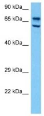 Western Blot: Carboxylesterase 1E/CES1E Antibody [NBP3-10170]