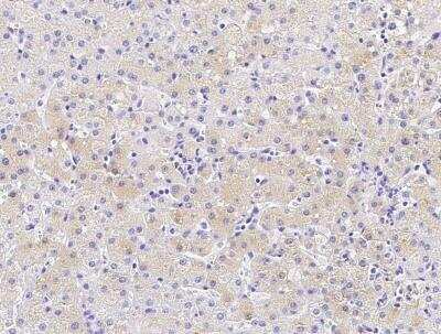 Immunohistochemistry-Paraffin: Carboxylesterase 3/CES3/Esterase 31 Antibody (033) [NBP2-89802]