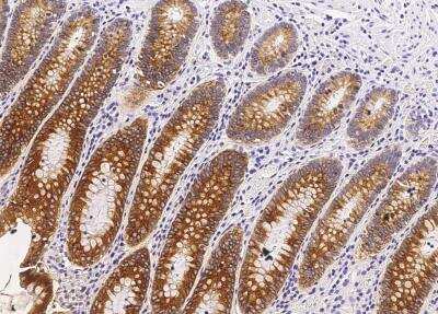 Immunohistochemistry-Paraffin: Carboxylesterase 3/CES3/Esterase 31 Antibody (033) [NBP2-89802]