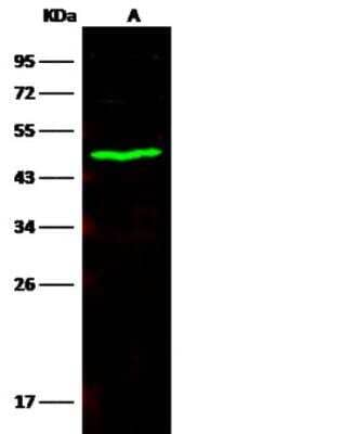 Western Blot: Carboxylesterase 3/CES3/Esterase 31 Antibody (372) [NBP2-89803]