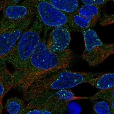 Immunocytochemistry/ Immunofluorescence: Carboxylesterase 3/CES3/Esterase 31 Antibody [NBP2-47529]