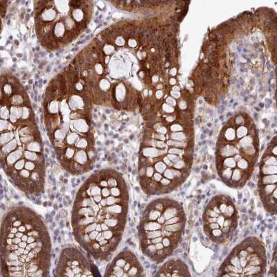 Immunohistochemistry: Carboxylesterase 3/CES3/Esterase 31 Antibody [NBP2-48728]