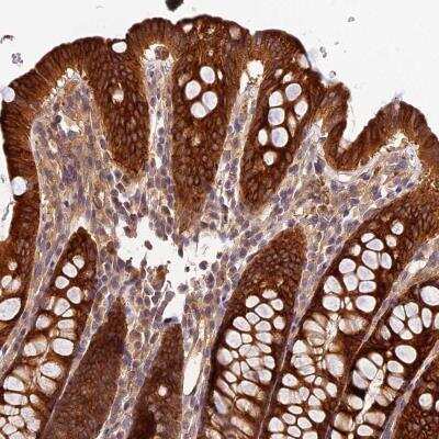 Immunohistochemistry-Paraffin: Carboxylesterase 3/CES3/Esterase 31 Antibody [NBP2-47529]