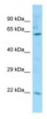 Western Blot: Carboxylesterase 3/CES3/Esterase 31 Antibody [NBP1-98271]