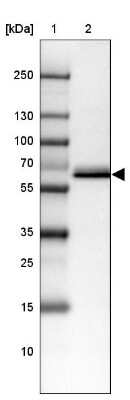 Western Blot: Carboxylesterase 3/CES3/Esterase 31 Antibody [NBP2-47529]