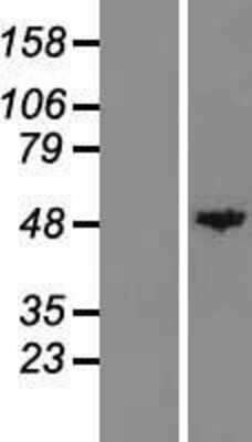 Western Blot: Carboxypeptidase A1/CPA1 Overexpression Lysate [NBL1-09424]