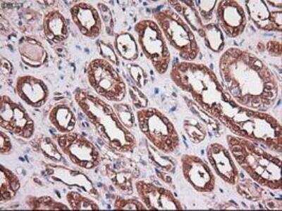 Immunohistochemistry-Paraffin: Carboxypeptidase A1/CPA1 Antibody (OTI2A3) [NBP1-47704]